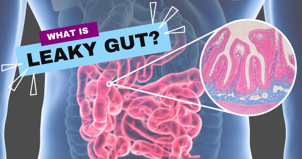 What is Leaky Gut?